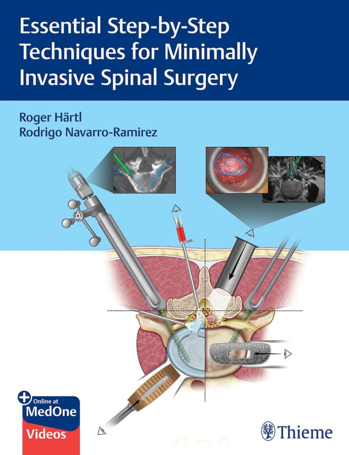 Essential Step-by-Step Techniques for Minimally Invasive Spinal Surgery Essential Step-by-Step Techniques for Minimally Invasive Spinal Surgery