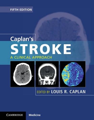 CAPLANS STROKE - LOUIS R. CAPLAN