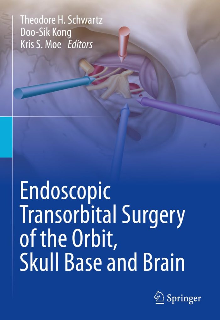 Endoscopic Transorbital Surgery of the Orbit, Skull Base and Brain Endoscopic Transorbital Surgery of the Orbit, Skull Base and Brain